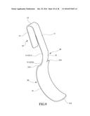 Tongue anteriorizer and method of operating same diagram and image