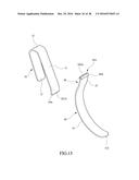 Tongue anteriorizer and method of operating same diagram and image