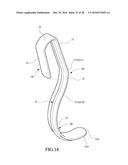 Tongue anteriorizer and method of operating same diagram and image