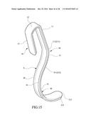 Tongue anteriorizer and method of operating same diagram and image