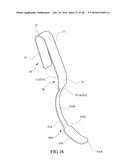 Tongue anteriorizer and method of operating same diagram and image