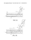 VASCULAR CLOSURE DEVICE WITH REMOVABLE GUIDE MEMBER diagram and image