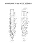 THREADED SUTURE ANCHOR diagram and image