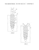 THREADED SUTURE ANCHOR diagram and image