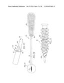 THREADED SUTURE ANCHOR diagram and image