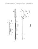 Medical Fastening Device diagram and image