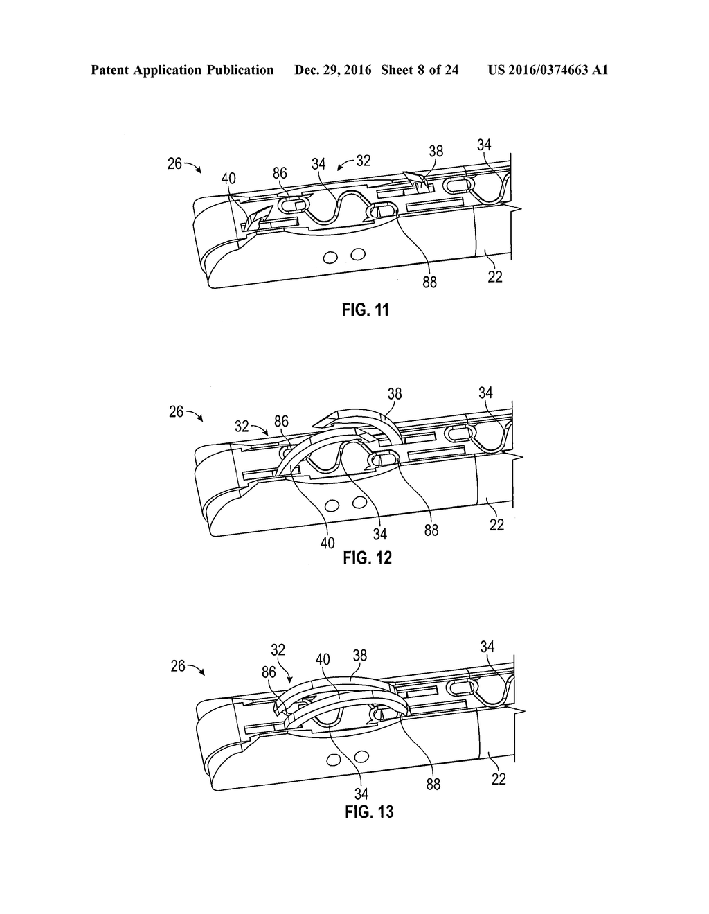 Medical Fastening Device - diagram, schematic, and image 09