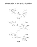 Medical Fastening Device diagram and image