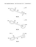 Medical Fastening Device diagram and image