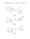 Medical Fastening Device diagram and image