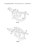 Medical Fastening Device diagram and image