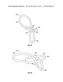 Medical Fastening Device diagram and image