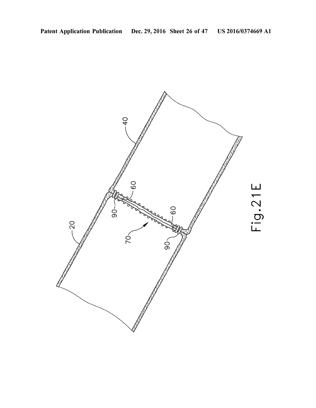 BAILOUT ASSEMBLY FOR SURGICAL STAPLER - diagram, schematic, and image 27