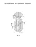 SURGICAL STAPLING INSTRUMENTS INCLUDING A CARTRIDGE HAVING MULTIPLE     STAPLES SIZES diagram and image