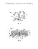 Variable Compression Surgical Fastener Cartridge diagram and image