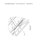 SURGICAL STAPLER WITH READY STATE INDICATOR diagram and image