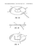 PARTIAL CUFF diagram and image