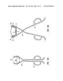 PARTIAL CUFF diagram and image