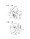 GRAFT PLACEMENT SYSTEM AND METHOD diagram and image