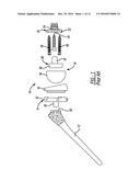 Patient-Specific Humeral Guide Designs diagram and image