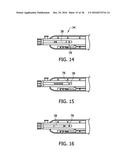 Tissue-Removing Catheter Including Operational Control Mechanism diagram and image