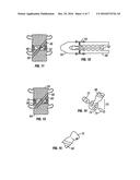 Distraction Screw diagram and image