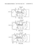 SUPPORT DEVICE AND METHOD diagram and image