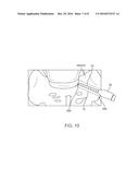 SUPPORT DEVICE AND METHOD diagram and image