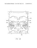 LAMINA IMPLANT AND METHOD diagram and image