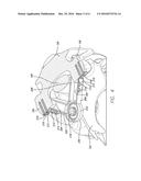 LAMINA IMPLANT AND METHOD diagram and image