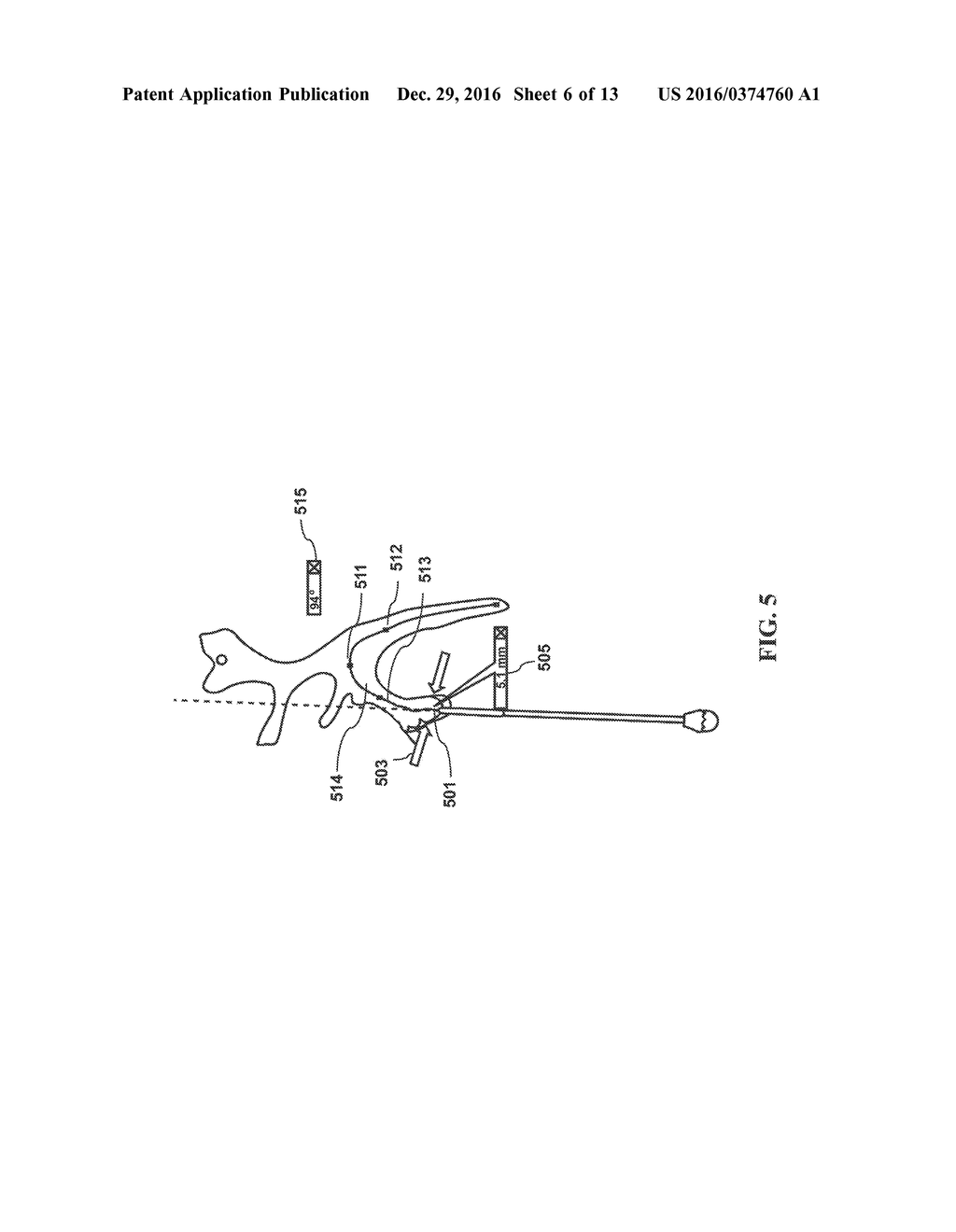 Method and System for Interactive 3D Scope Placement and Measurements for     Kidney Stone Removal Procedure - diagram, schematic, and image 07