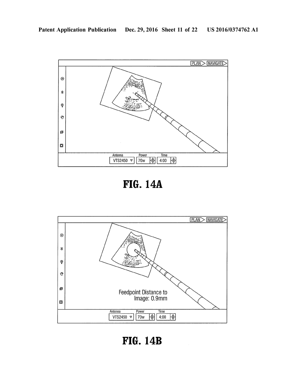 Surgical Navigation System - diagram, schematic, and image 12