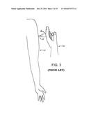 SHARPS END CAPTURE DEVICE AND METHOD diagram and image