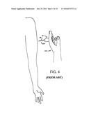 SHARPS END CAPTURE DEVICE AND METHOD diagram and image