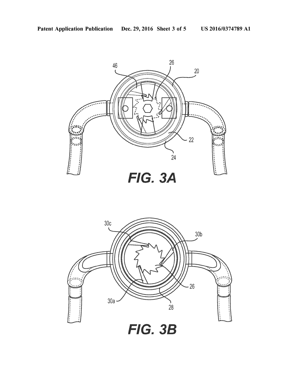 IMPLANTS, TOOLS, AND METHODS FOR TREATMENT OF PELVIC CONDITIONS - diagram, schematic, and image 04