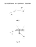 MULTIPLE IMPLANT CONSTRUCTIONS AND FIXATION METHODS ASSOCIATED THEREWITH diagram and image