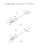 MULTIPLE IMPLANT CONSTRUCTIONS AND FIXATION METHODS ASSOCIATED THEREWITH diagram and image