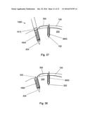 MULTIPLE IMPLANT CONSTRUCTIONS AND FIXATION METHODS ASSOCIATED THEREWITH diagram and image