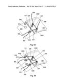 MULTIPLE IMPLANT CONSTRUCTIONS AND FIXATION METHODS ASSOCIATED THEREWITH diagram and image