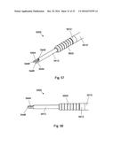 MULTIPLE IMPLANT CONSTRUCTIONS AND FIXATION METHODS ASSOCIATED THEREWITH diagram and image