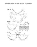 PROSTHETIC HEART VALVE diagram and image