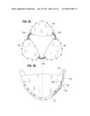 PROSTHETIC HEART VALVE diagram and image