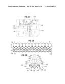 PROSTHETIC HEART VALVE diagram and image