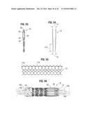 PROSTHETIC HEART VALVE diagram and image