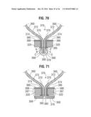 PROSTHETIC HEART VALVE diagram and image