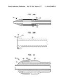 RETAINERS FOR TRANSCATHETER HEART VALVE DELIVERY SYSTEMS diagram and image