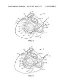 TISSUE SHAPING DEVICE diagram and image