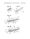 FLEXIBLE ELONGATED CHAIN IMPLANT AND METHOD OF SUPPORTING BODY TISSUE WITH     SAME diagram and image