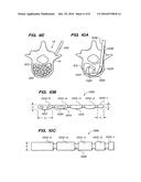 FLEXIBLE ELONGATED CHAIN IMPLANT AND METHOD OF SUPPORTING BODY TISSUE WITH     SAME diagram and image