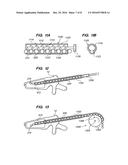 FLEXIBLE ELONGATED CHAIN IMPLANT AND METHOD OF SUPPORTING BODY TISSUE WITH     SAME diagram and image